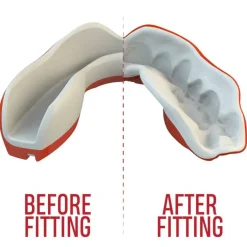 SafeJawz Extro Series Viper Sports Mouthguard