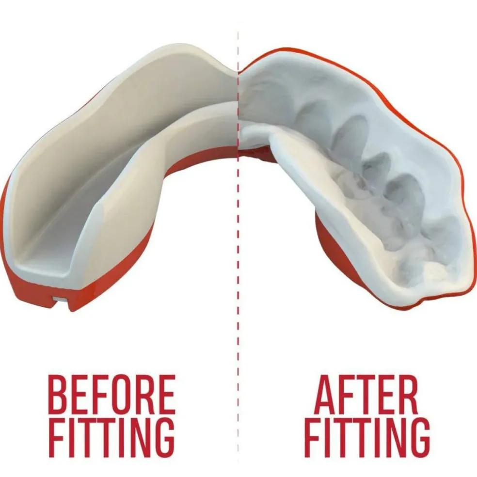 SafeJawz Extro Series Viper Sports Mouthguard